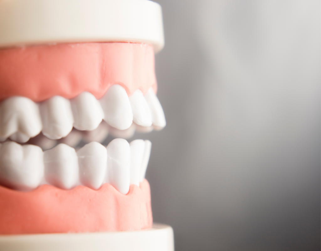 teeth and gum model