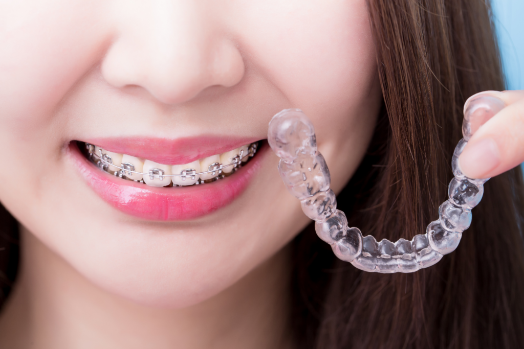 girl with braces holding invisalign tray