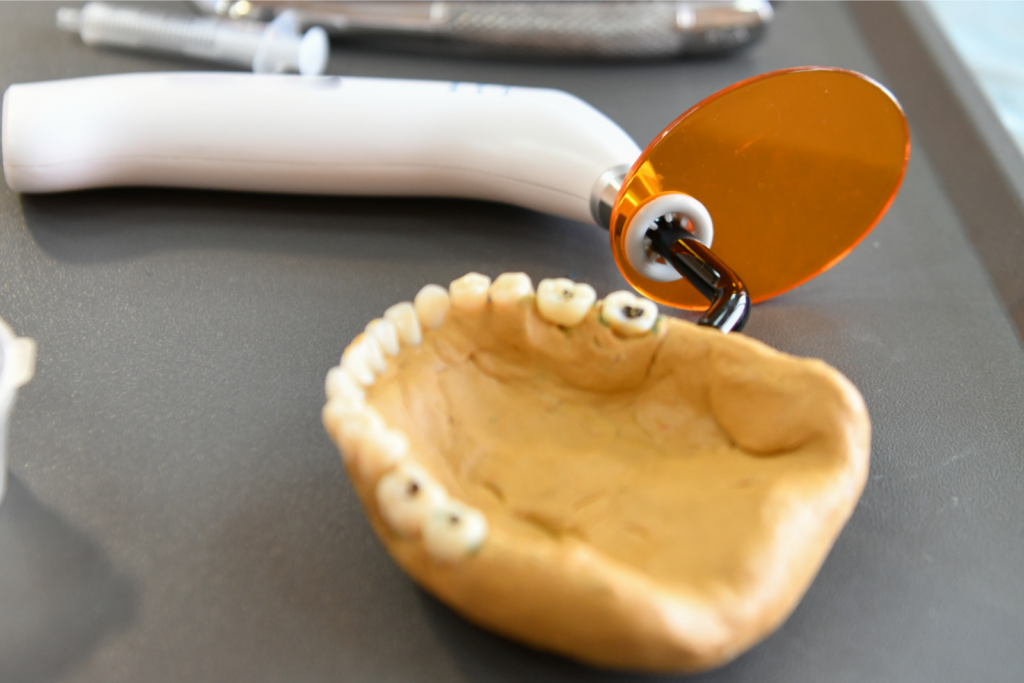 model of dental filling